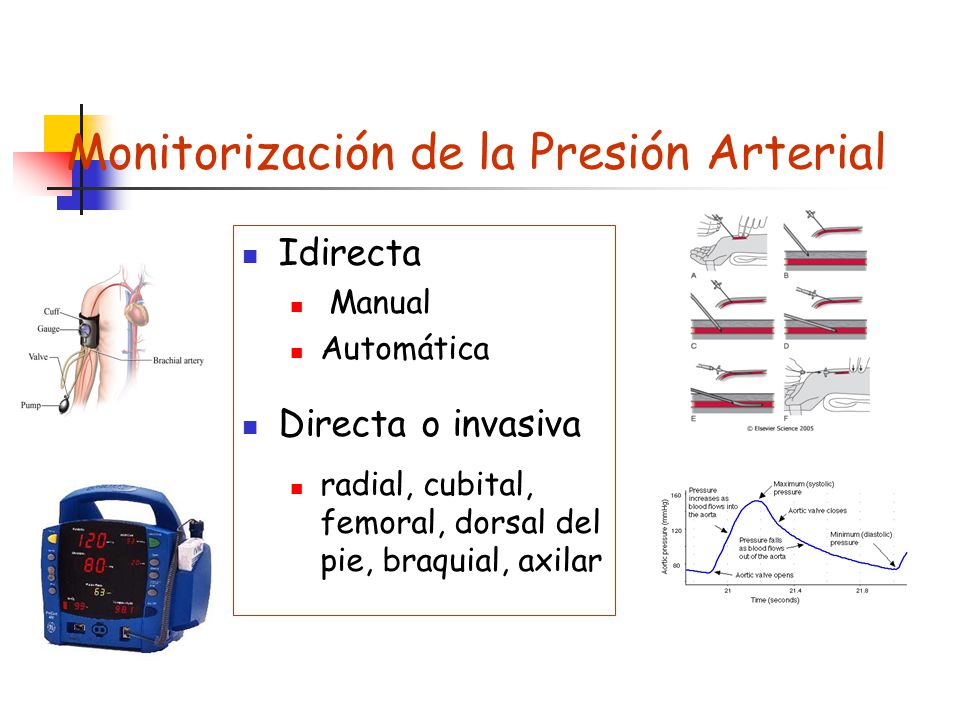 Monitorización de la Presión Arterial