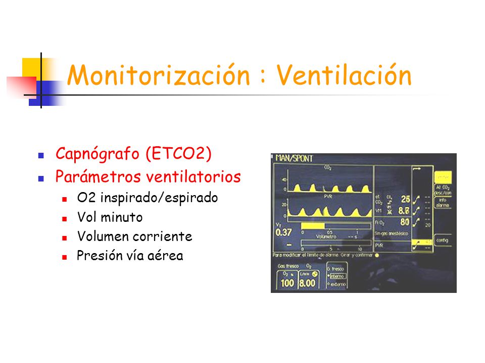Monitorización : Ventilación