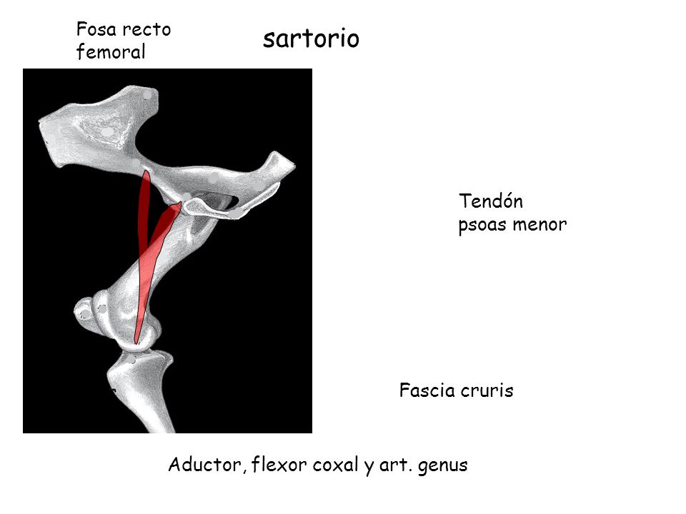 sartorio Fosa recto femoral Tendón psoas menor Fascia cruris