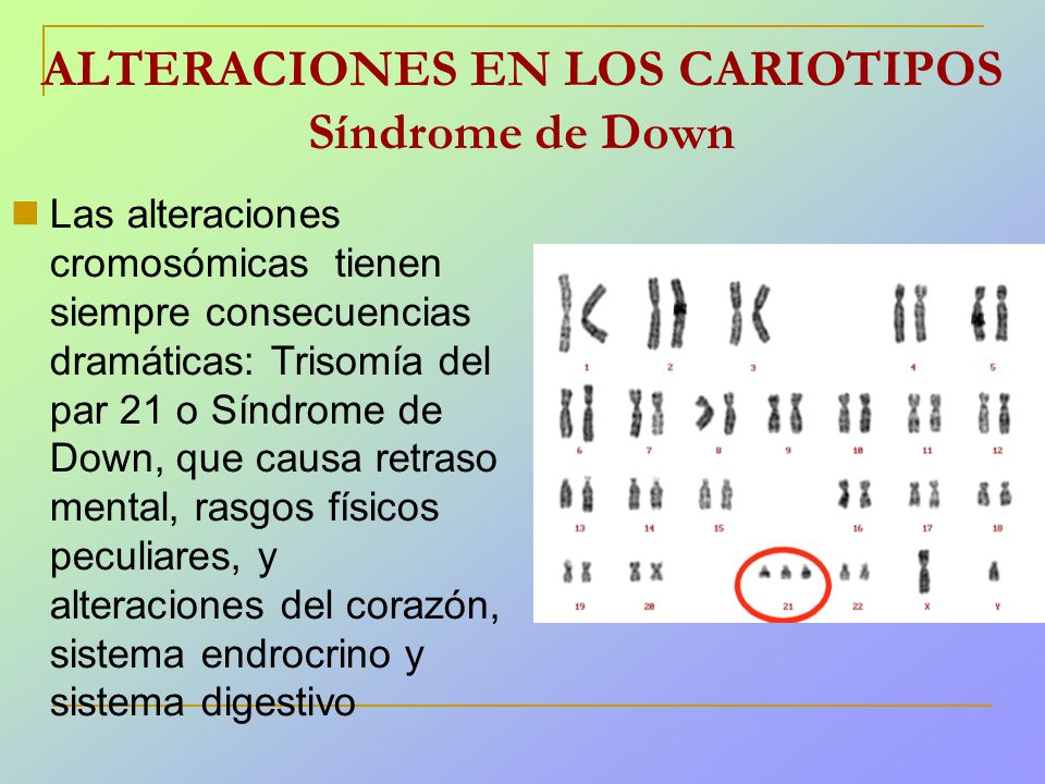 ALTERACIONES EN LOS CARIOTIPOS Síndrome de Down