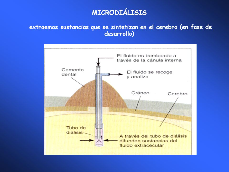 MICRODIÁLISIS extraemos sustancias que se sintetizan en el cerebro (en fase de desarrollo)