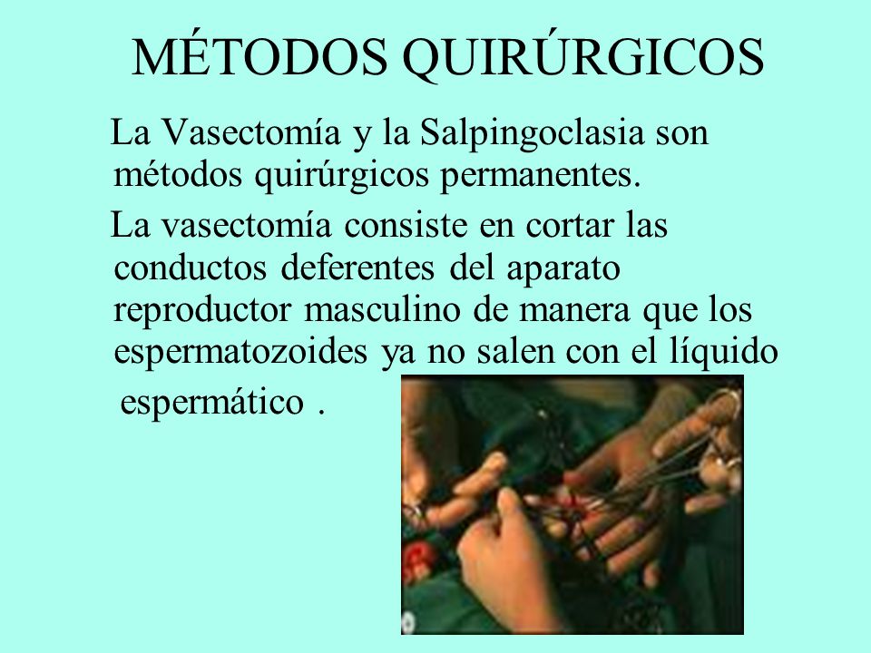 MÉTODOS QUIRÚRGICOS La Vasectomía y la Salpingoclasia son métodos quirúrgicos permanentes.