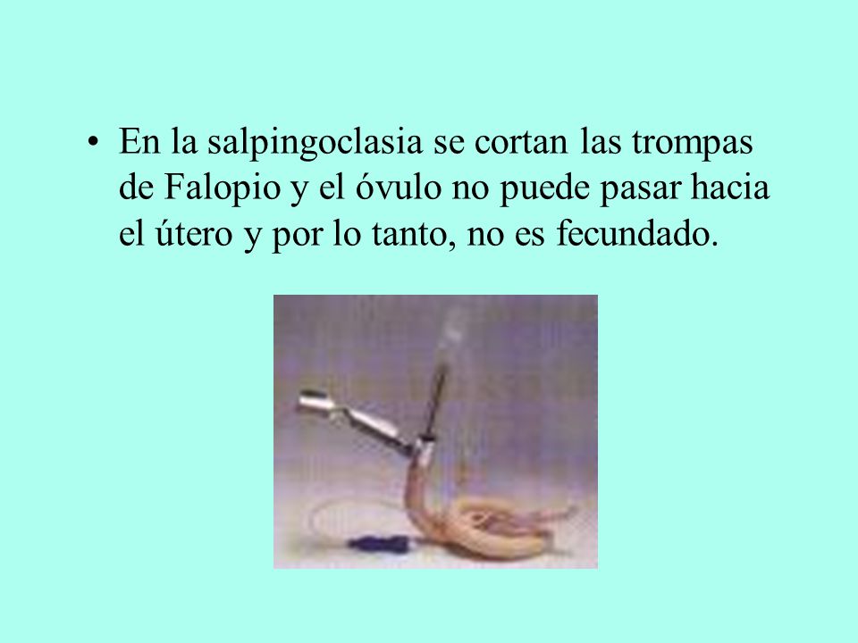 En la salpingoclasia se cortan las trompas de Falopio y el óvulo no puede pasar hacia el útero y por lo tanto, no es fecundado.