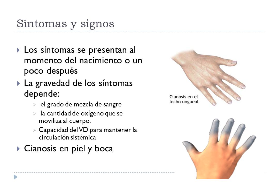 Síntomas y signos Los síntomas se presentan al momento del nacimiento o un poco después. La gravedad de los síntomas depende: