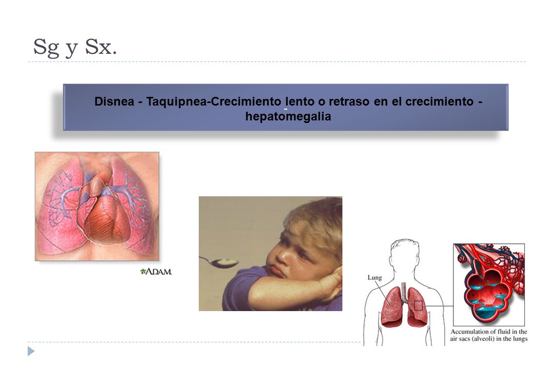 Sg y Sx. - Disnea - Taquipnea-Crecimiento lento o retraso en el crecimiento - hepatomegalia.