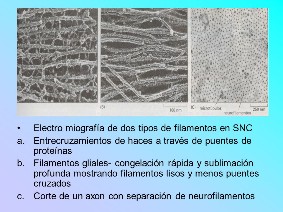 Electro miografía de dos tipos de filamentos en SNC