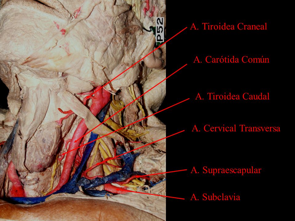 A. Tiroidea Craneal A. Carótida Común. A. Tiroidea Caudal. A. Cervical Transversa. A. Supraescapular.