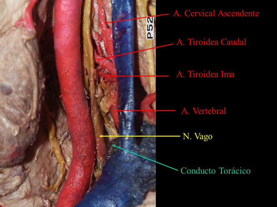 A. Cervical Ascendente A. Tiroidea Caudal A. Tiroidea Ima A. Vertebral N. Vago Conducto Torácico