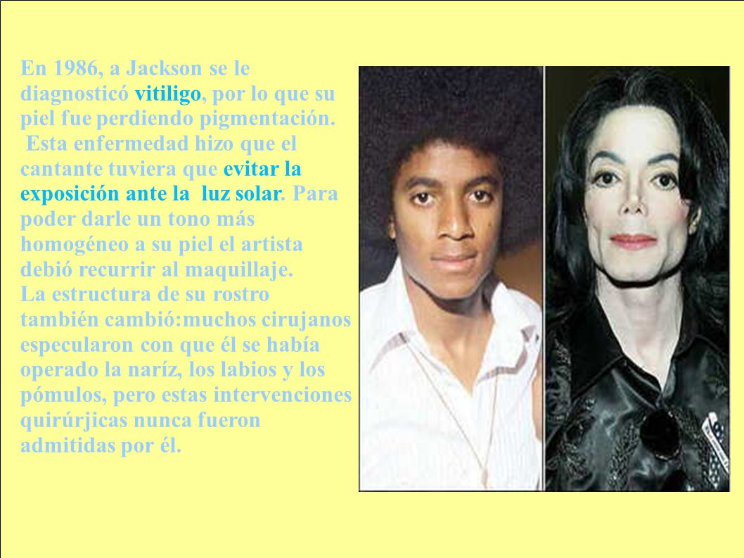 En 1986, a Jackson se le diagnosticó vitiligo, por lo que su piel fue perdiendo pigmentación.