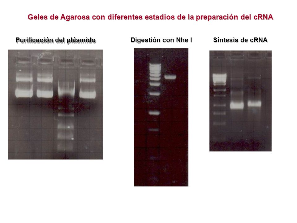 Geles de Agarosa con diferentes estadios de la preparación del cRNA