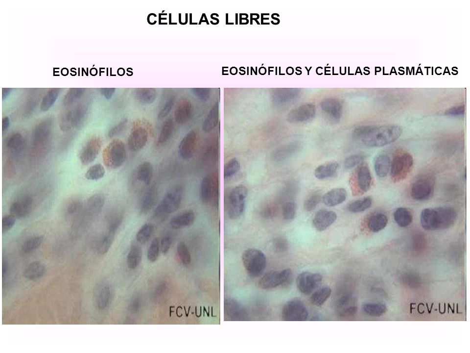 CÉLULAS LIBRES EOSINÓFILOS EOSINÓFILOS Y CÉLULAS PLASMÁTICAS