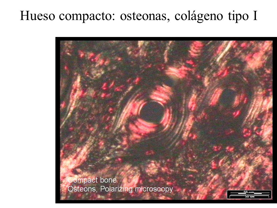 Hueso compacto: osteonas, colágeno tipo I