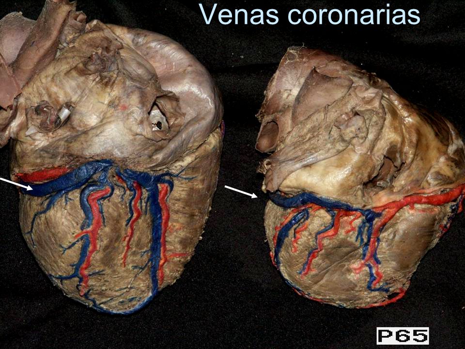 Venas coronarias