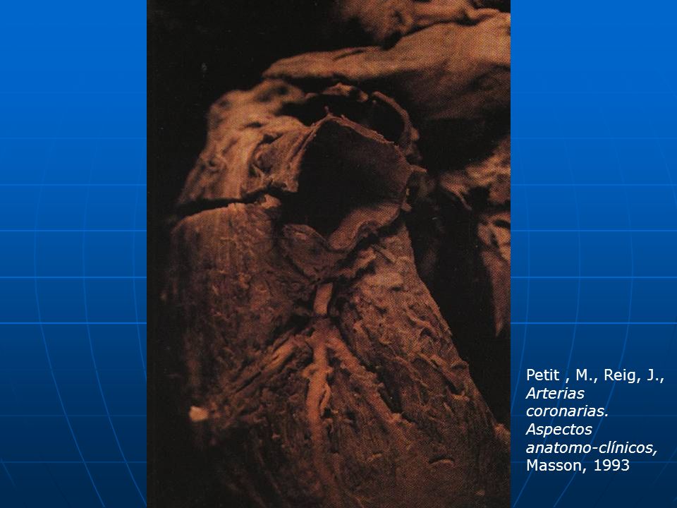 Petit , M. , Reig, J. , Arterias coronarias
