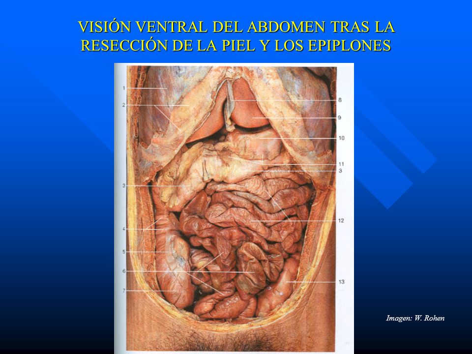 VISIÓN VENTRAL DEL ABDOMEN TRAS LA RESECCIÓN DE LA PIEL Y LOS EPIPLONES
