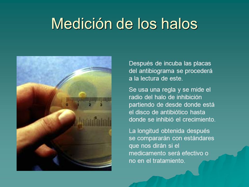 Medición de los halos Después de incuba las placas del antibiograma se procederá a la lectura de este.