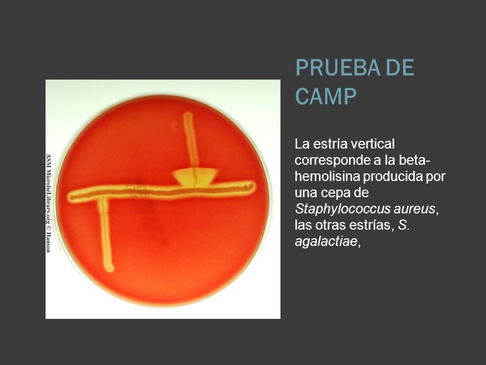 PRUEBA DE CAMP La estría vertical corresponde a la beta-hemolisina producida por una cepa de Staphylococcus aureus, las otras estrías, S.