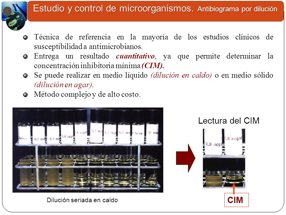 Estudio y control de microorganismos. Antibiograma por dilución