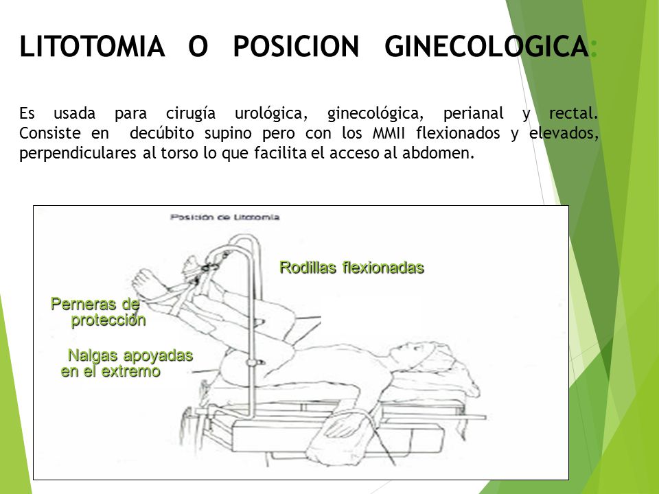 LITOTOMIA O POSICION GINECOLOGICA: Es usada para cirugía urológica, ginecológica, perianal y rectal. Consiste en decúbito supino pero con los MMII flexionados y elevados, perpendiculares al torso lo que facilita el acceso al abdomen.