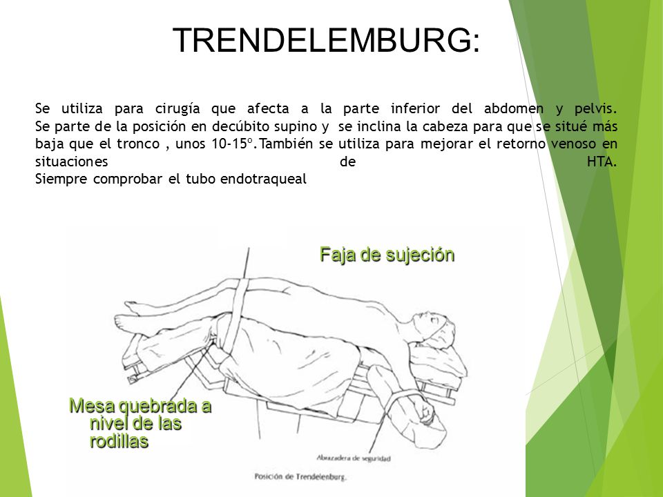 TRENDELEMBURG: Se utiliza para cirugía que afecta a la parte inferior del abdomen y pelvis. Se parte de la posición en decúbito supino y se inclina la cabeza para que se situé más baja que el tronco , unos 10-15º.También se utiliza para mejorar el retorno venoso en situaciones de HTA. Siempre comprobar el tubo endotraqueal