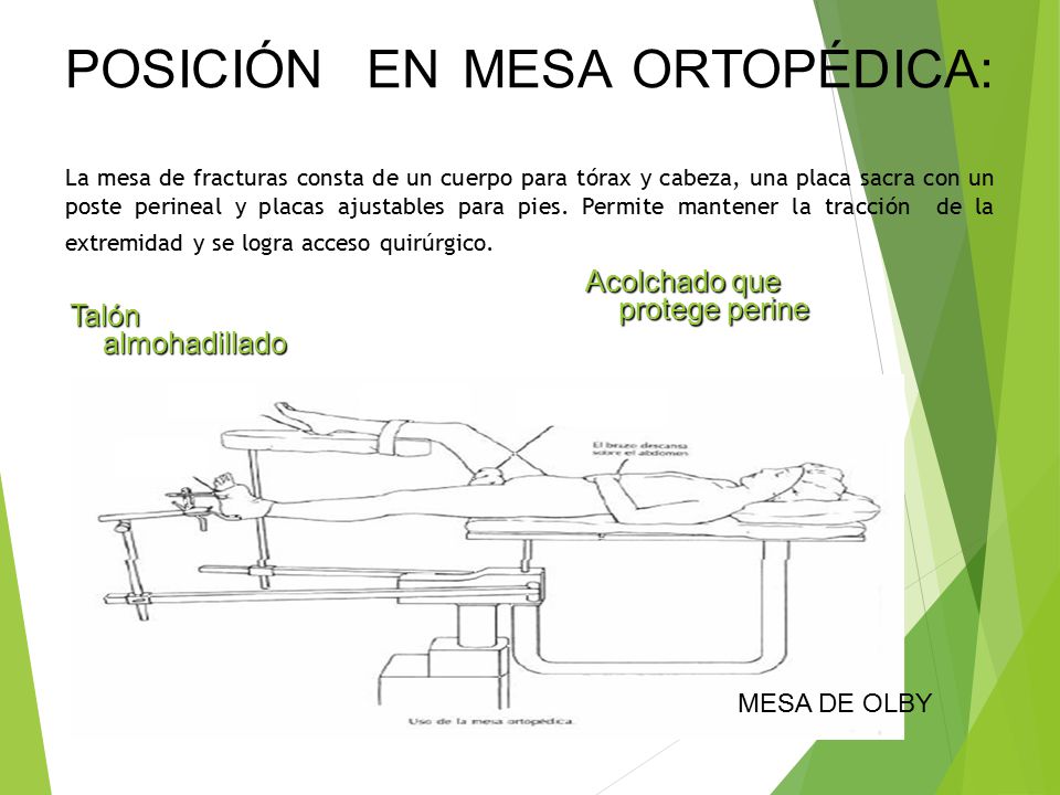 POSICIÓN EN MESA ORTOPÉDICA: La mesa de fracturas consta de un cuerpo para tórax y cabeza, una placa sacra con un poste perineal y placas ajustables para pies. Permite mantener la tracción de la extremidad y se logra acceso quirúrgico.