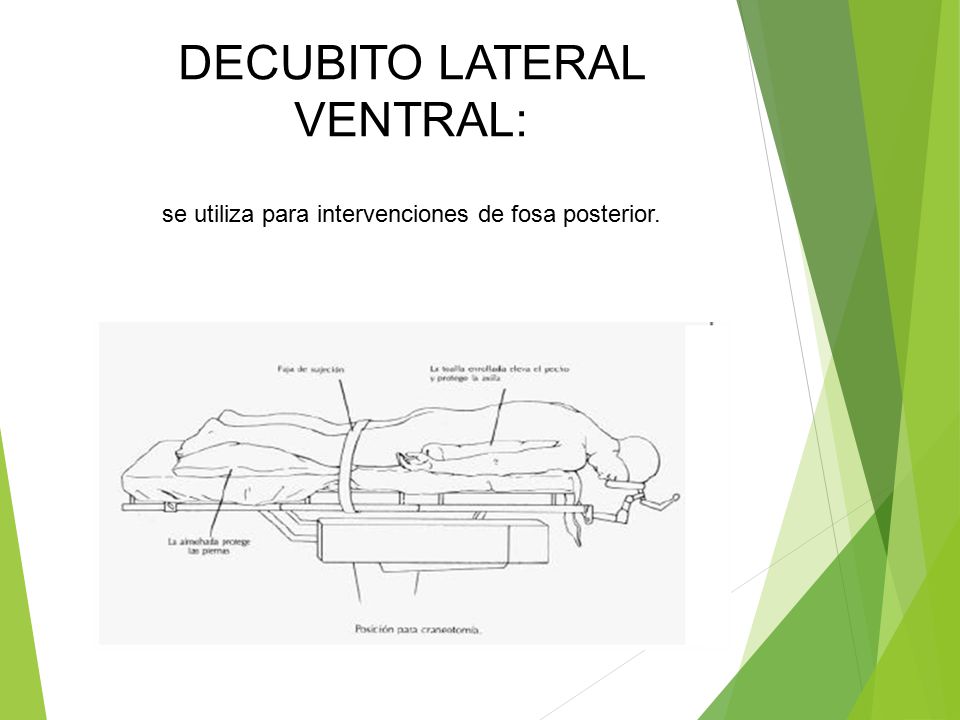 DECUBITO LATERAL VENTRAL: se utiliza para intervenciones de fosa posterior.