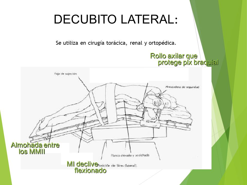 DECUBITO LATERAL: Se utiliza en cirugía torácica, renal y ortopédica.