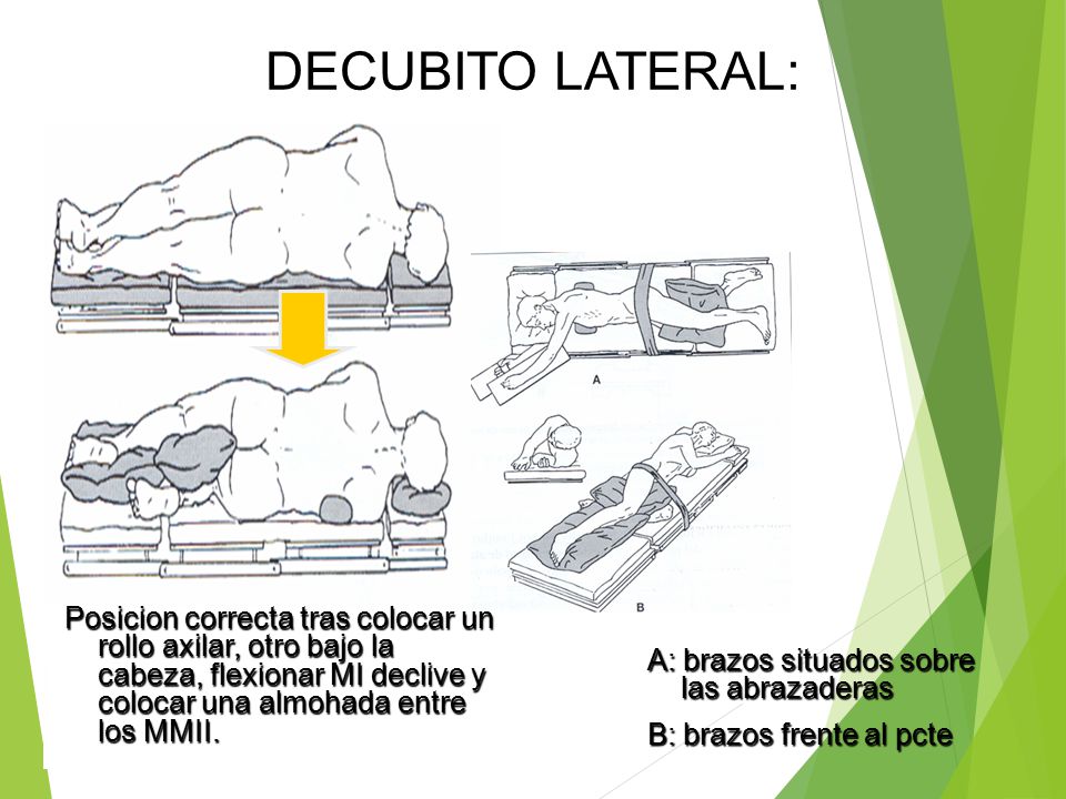 DECUBITO LATERAL: Posicion correcta tras colocar un rollo axilar, otro bajo la cabeza, flexionar MI declive y colocar una almohada entre los MMII.