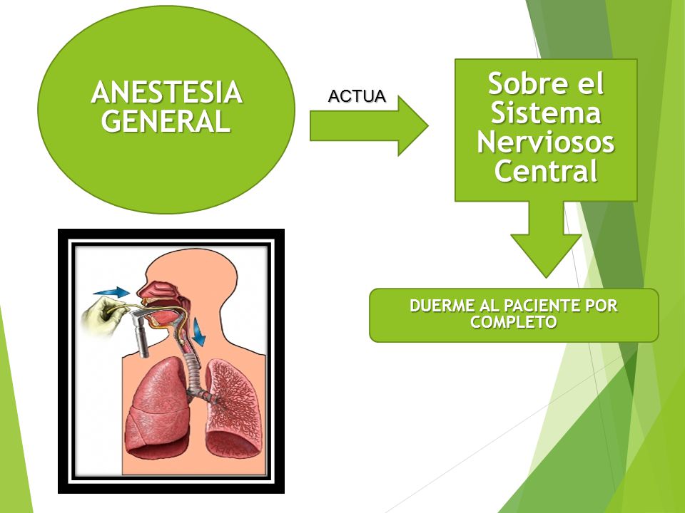 Sobre el Sistema Nerviosos Central DUERME AL PACIENTE POR COMPLETO