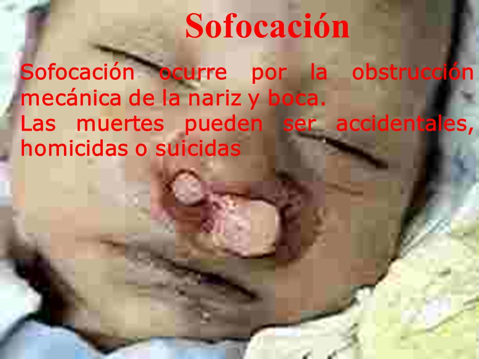 Sofocación Sofocación ocurre por la obstrucción mecánica de la nariz y boca.