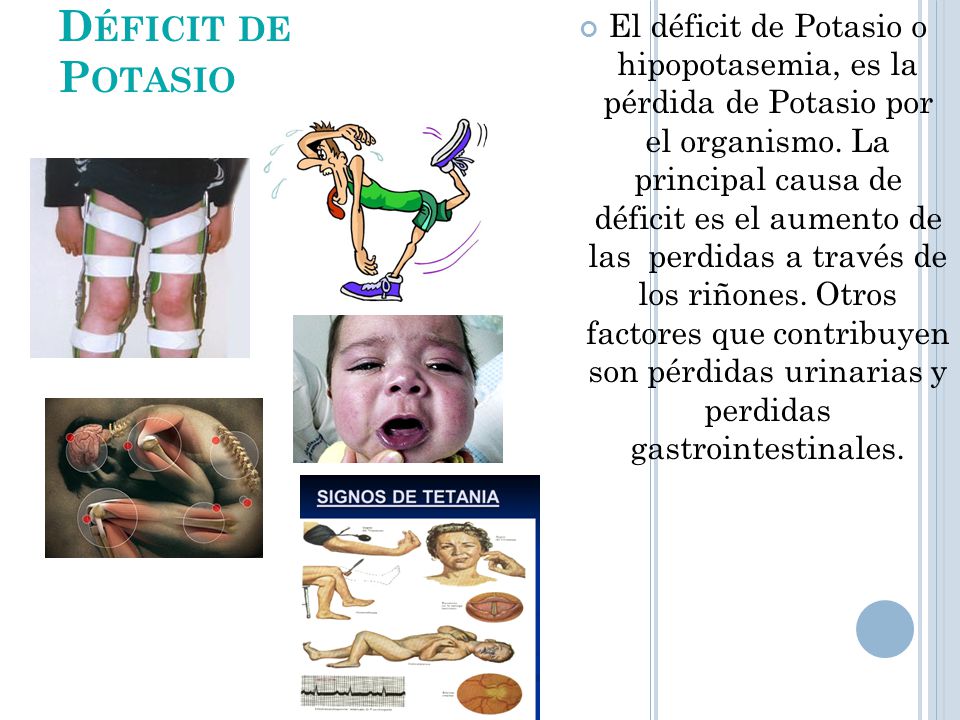 El déficit de Potasio o hipopotasemia, es la pérdida de Potasio por el organismo. La principal causa de déficit es el aumento de las perdidas a través de los riñones. Otros factores que contribuyen son pérdidas urinarias y perdidas gastrointestinales.