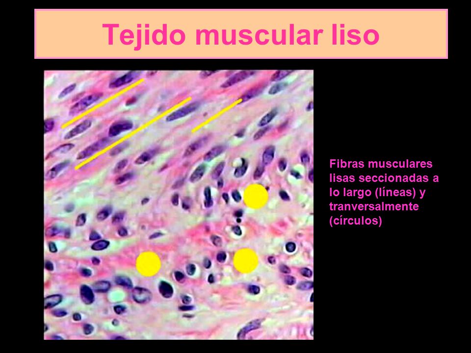 Tejido muscular liso Fibras musculares lisas seccionadas a lo largo (líneas) y tranversalmente (círculos)