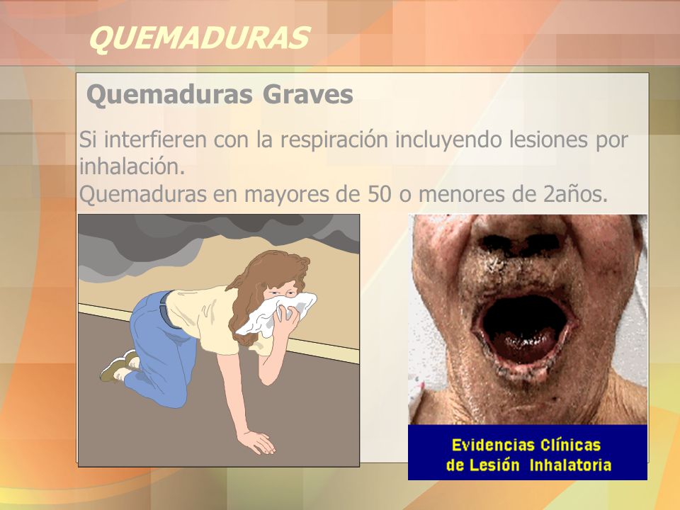 QUEMADURAS Quemaduras Graves