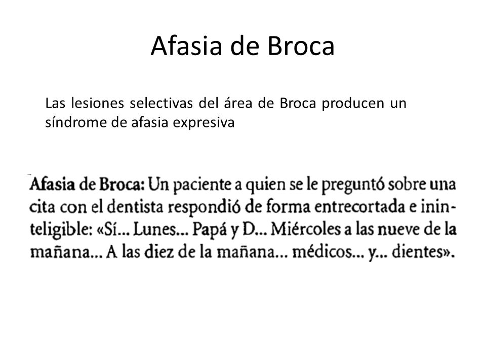Afasia de Broca Las lesiones selectivas del área de Broca producen un síndrome de afasia expresiva