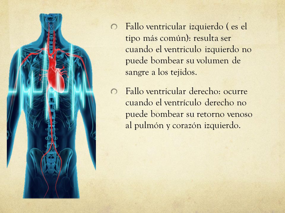 Fallo ventricular izquierdo ( es el tipo más común): resulta ser cuando el ventriculo izquierdo no puede bombear su volumen de sangre a los tejidos.