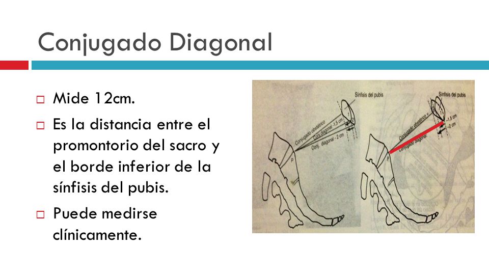 Conjugado Diagonal Mide 12cm.