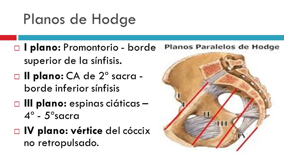 Planos de Hodge I plano: Promontorio - borde superior de la sínfisis.