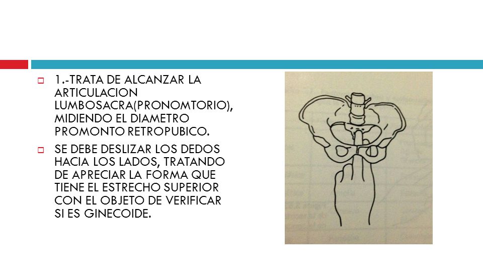 1.-TRATA DE ALCANZAR LA ARTICULACION LUMBOSACRA(PRONOMTORIO), MIDIENDO EL DIAMETRO PROMONTO RETROPUBICO.