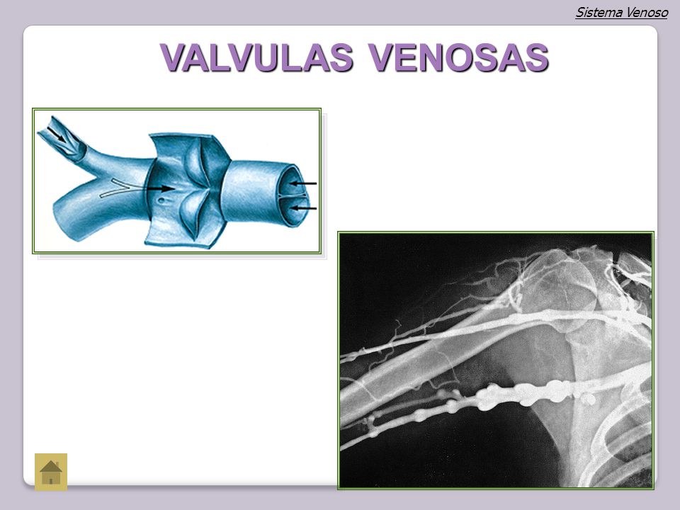 Sistema Venoso VALVULAS VENOSAS