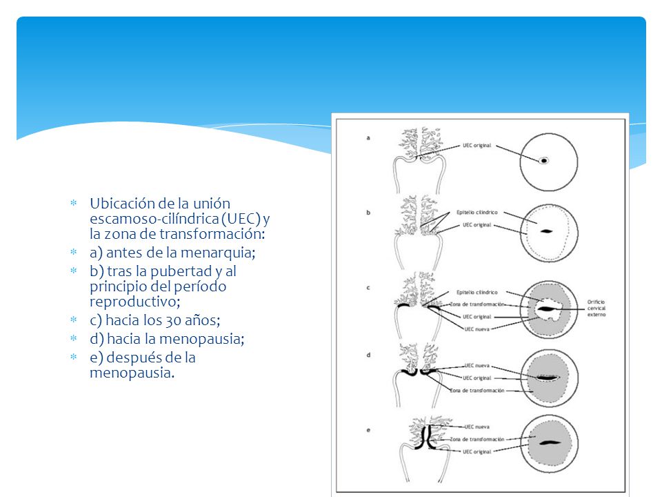 Ubicación de la unión escamoso-cilíndrica (UEC) y la zona de transformación: