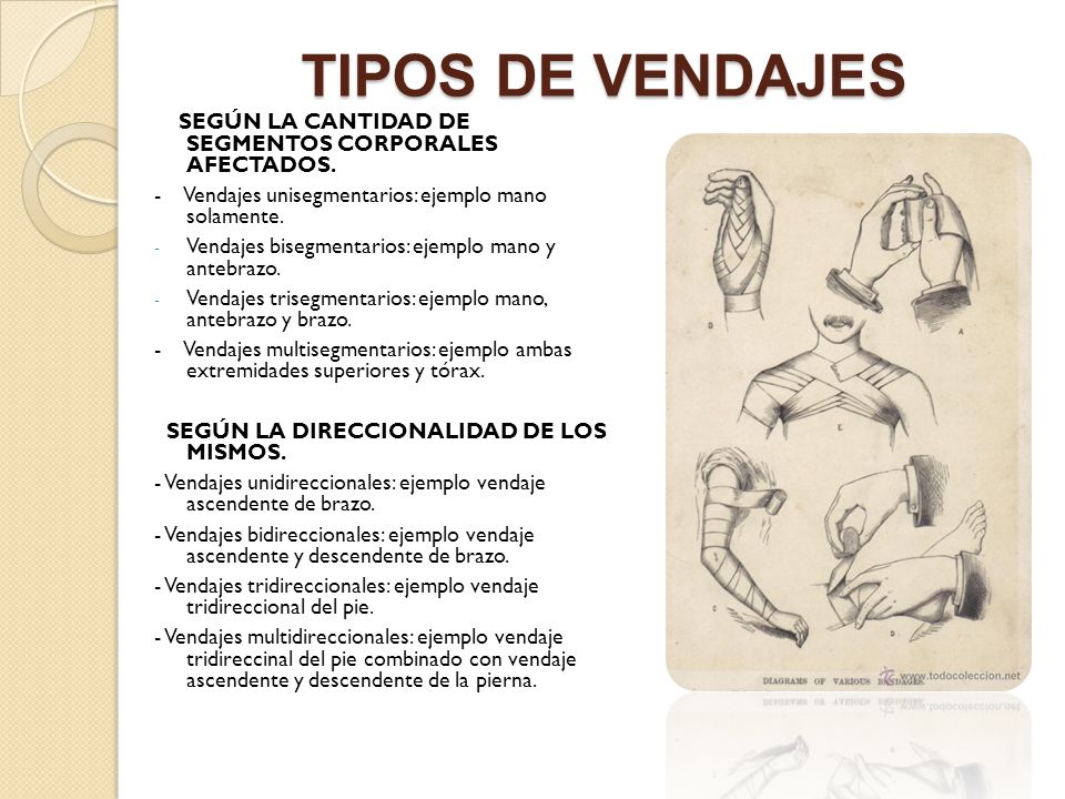 TIPOS DE VENDAJES SEGÚN LA CANTIDAD DE SEGMENTOS CORPORALES AFECTADOS.
