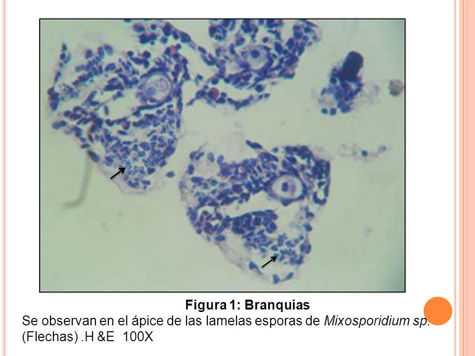 Figura 1: Branquias Se observan en el ápice de las lamelas esporas de Mixosporidium sp.