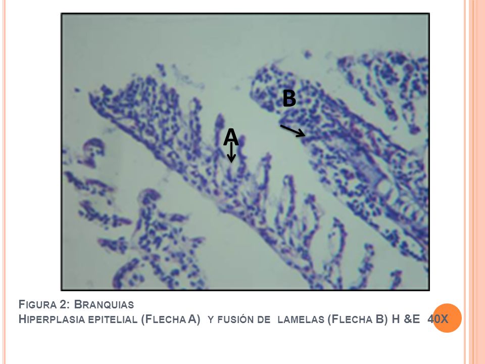 B A Figura 2: Branquias Hiperplasia epitelial (Flecha A) y fusión de lamelas (Flecha B) H &E 40X