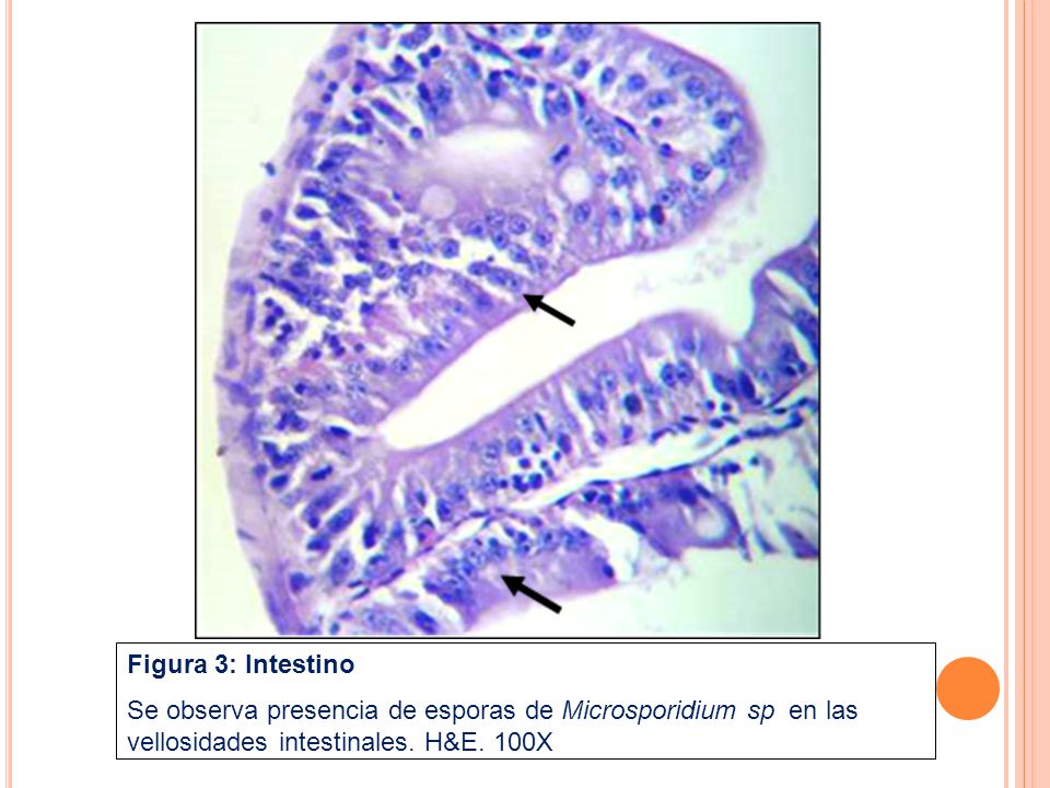 Figura 3: Intestino Se observa presencia de esporas de Microsporidium sp en las vellosidades intestinales.