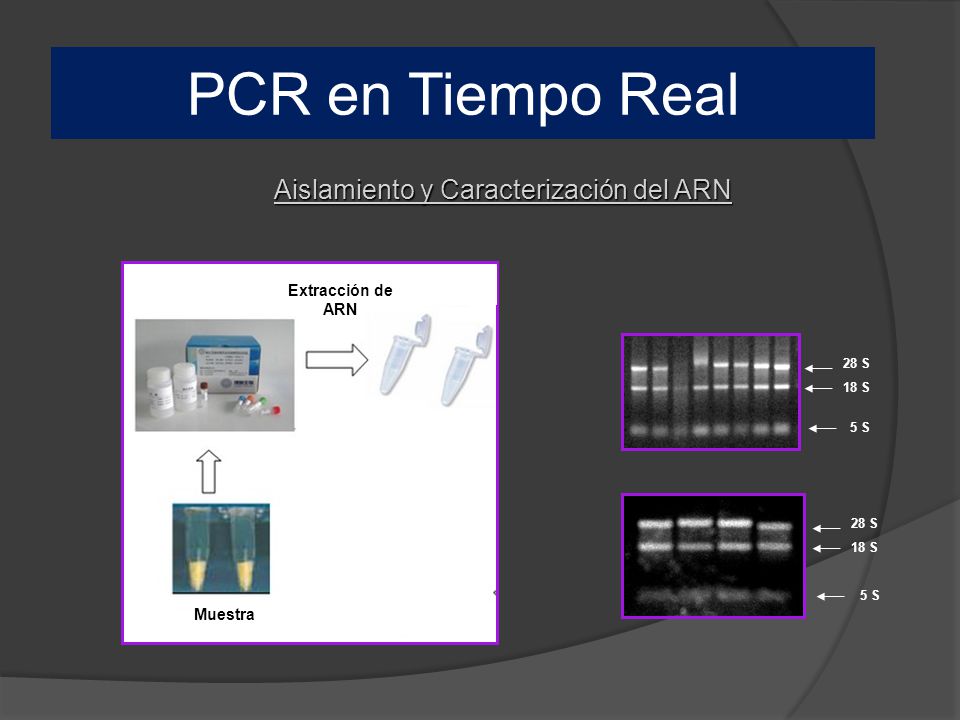 PCR en Tiempo Real. - ppt video online descargar