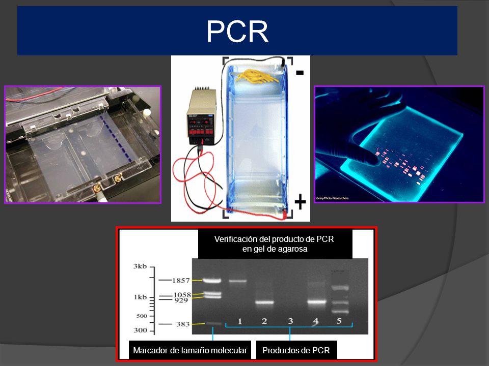 PCR Verificación del producto de PCR en gel de agarosa