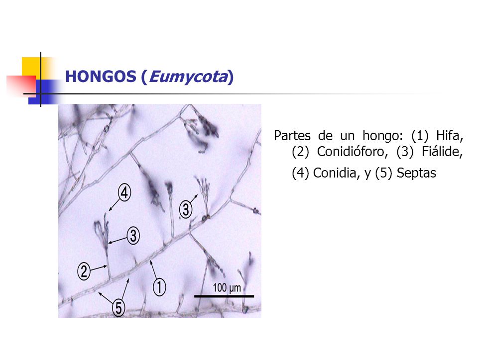 HONGOS (Eumycota) Partes de un hongo: (1) Hifa, (2) Conidióforo, (3) Fiálide, (4) Conidia, y (5) Septas.