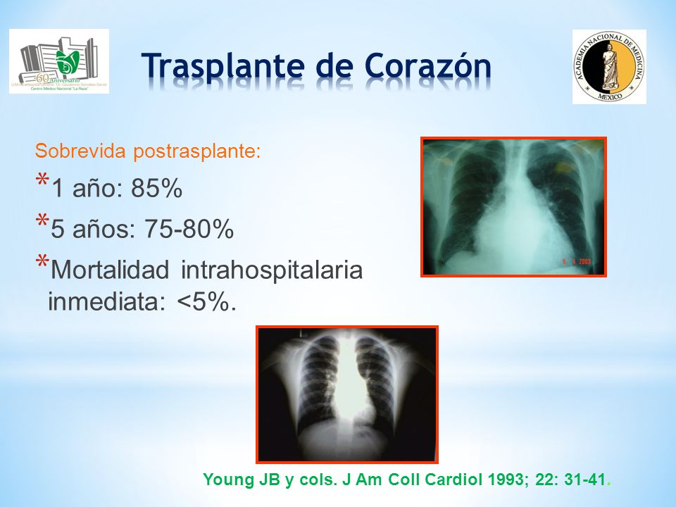Trasplante de Corazón 1 año: 85% 5 años: 75-80%