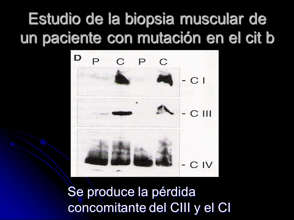 Estudio de la biopsia muscular de un paciente con mutación en el cit b