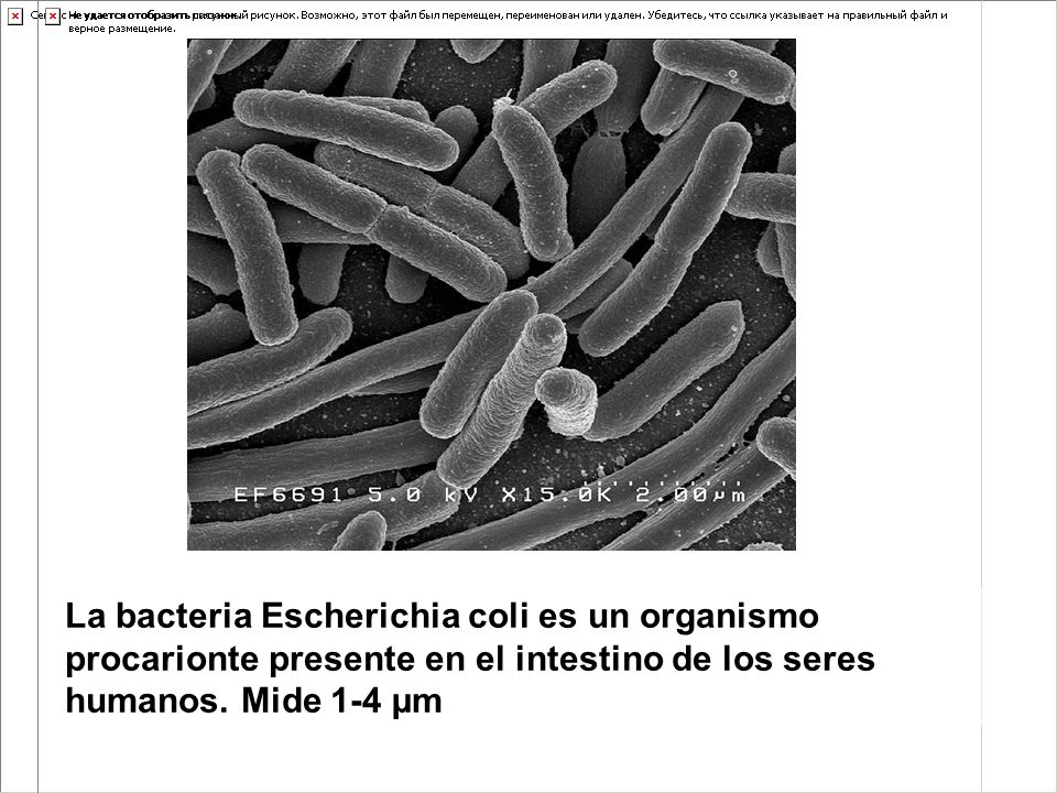 La bacteria Escherichia coli es un organismo procarionte presente en el intestino de los seres humanos.